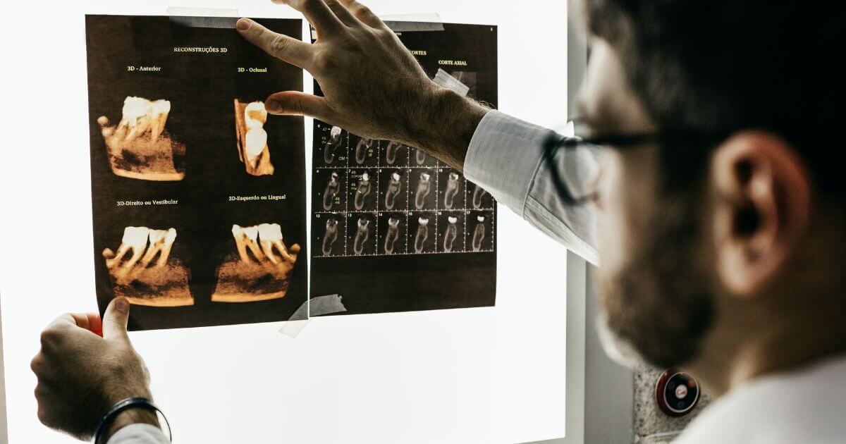 featured article image